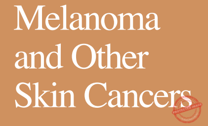 Melanoma And Other Skin Cancers ! - ExcelReads